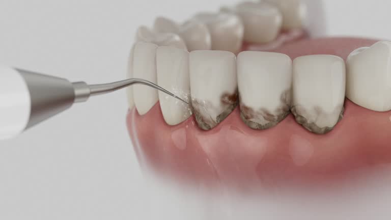Trusted Tooth Extraction service in Pleasant Hills, MD - Dentist Open Now